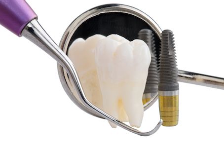 dental implant tools